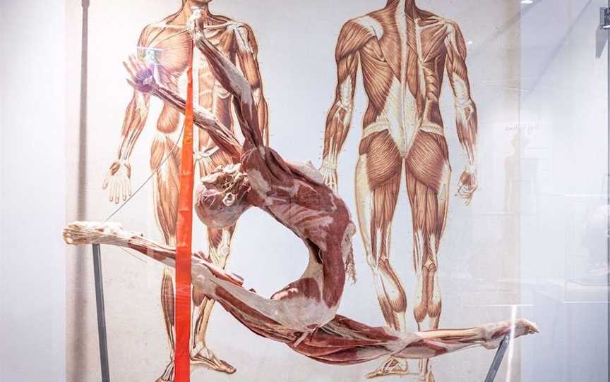 The Real Human Anatomy Exhibition, Attractions in Surfers Paradise